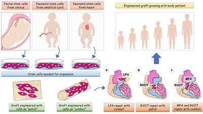 Personalized Cardiovascular Regenerative Medicine: Targeting the Extreme Stages of Life